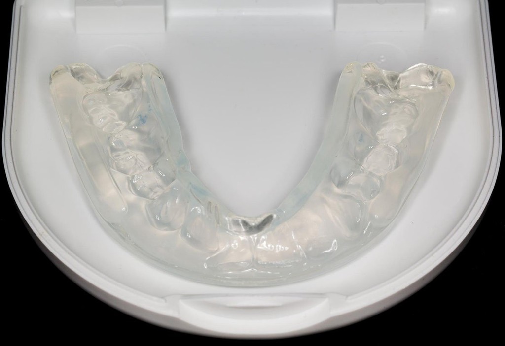 Benefits Of Custom-Made Mouthguards At Smile First Dental