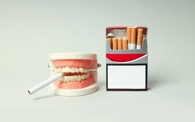 Smoking and Dental Health: The Overlooked Risks to Your Mouth