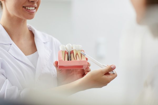 dental implants northmead