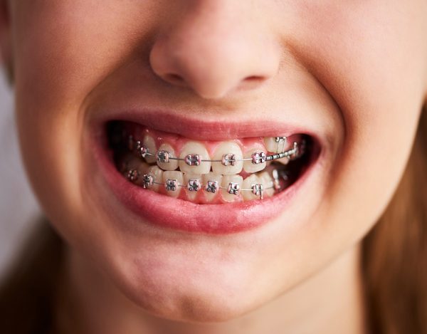orthodontics northmead