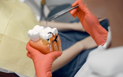 Root Canal Treatment Prevents Your Tooth From Extraction