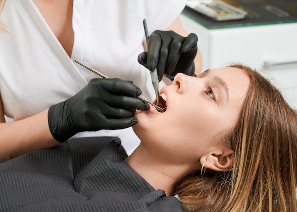 tooth fillings procedure northmead