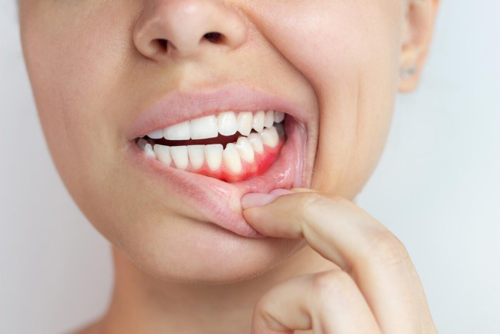 how gum disease can lead to other health issues