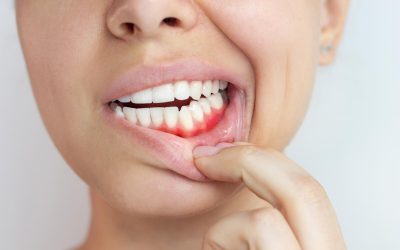 How Gum Disease Can Lead To Other Health Issues