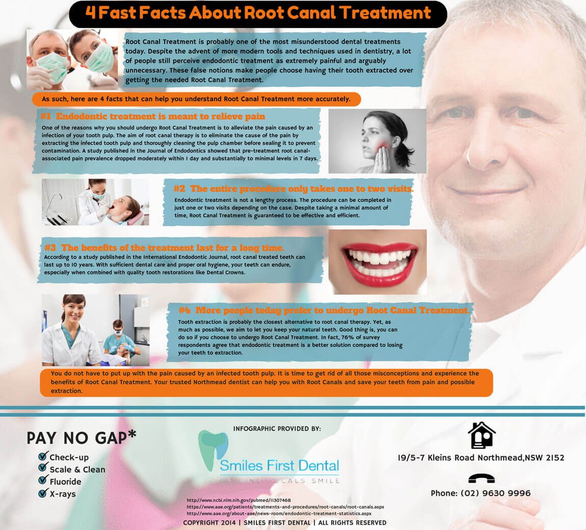 4-Fast-Facts-About-Root-Canal-Treatment