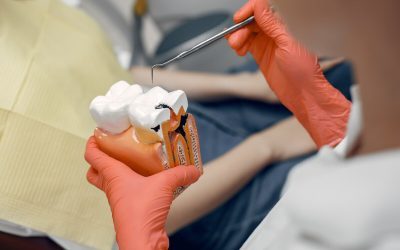 Root Canal Treatment Prevents Your Tooth From Extraction