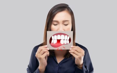 9 Tooth Loss Risk Factors: Advice from Northmead Dentist