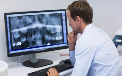 Dental X-rays: Detect Hidden Oral Health Issues Early