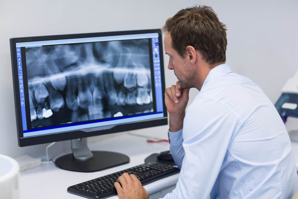 dental x-rays detect hidden oral health issues early