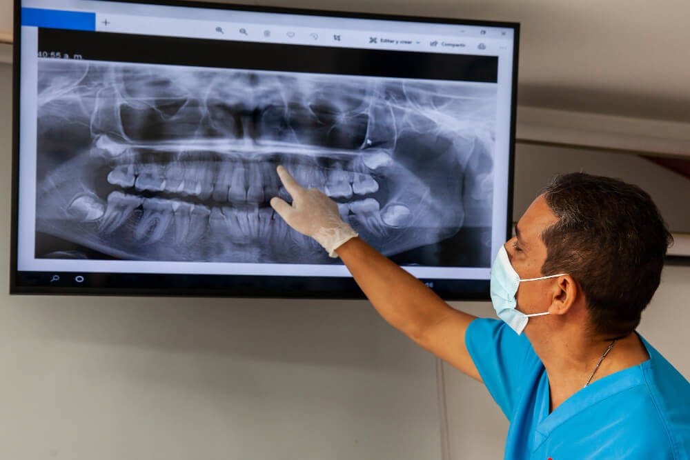 what dental x-rays can reveal