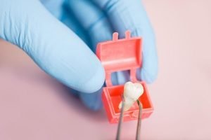 Wisdom Tooth Removal | Dentist Northmead