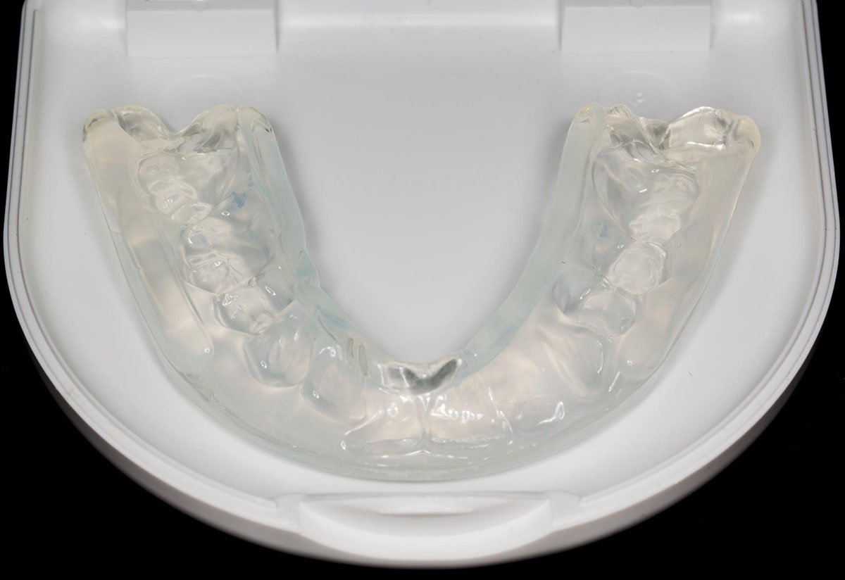 Benefits Of Custom-Made Mouthguards At Smile First Dental