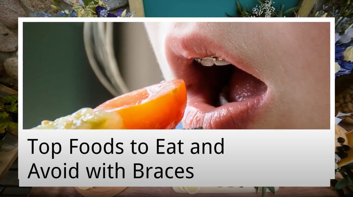 top foods to eat and avoid with braces from smiles first dental