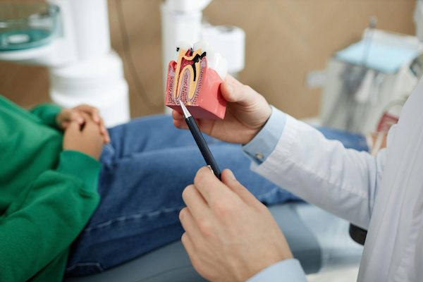 root canal treatment northmead