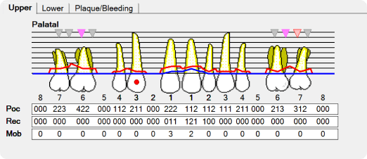 periodontal chart